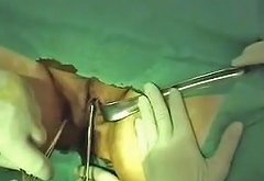 Orrudi Free Fisting Medical Porn Video E7 Xhamster